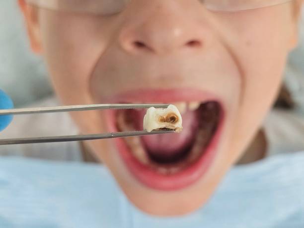 Best Tooth Infection Emergency Dentist  in Mineral Point, WI